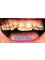Salvatori Dentist - Sonora 103-D, Nuevo Progreso, Tamaulipas, 88801,  10