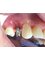Salvatori Dentist - Sonora 103-D, Nuevo Progreso, Tamaulipas, 88801,  4