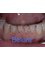 Salvatori Dentist - Sonora 103-D, Nuevo Progreso, Tamaulipas, 88801,  12