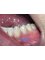 Salvatori Dentist - Sonora 103-D, Nuevo Progreso, Tamaulipas, 88801,  3