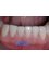 Salvatori Dentist - Sonora 103-D, Nuevo Progreso, Tamaulipas, 88801,  13