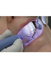 Ultrasonic Scaling - Dental Bio Esthetics