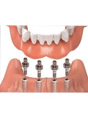 Overdentures - Dental Bio Esthetics