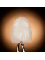 Lumineers™ - Dental Bio Esthetics