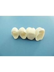 Porcelain Bridge - Dental Bio Esthetics