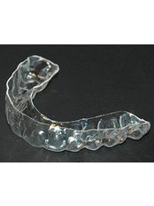 Orthodontic Retainer - Playa Smile