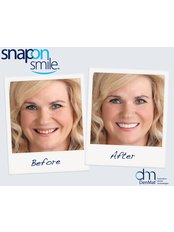 Snap-On Smile™ - Dental Cosmetics