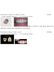 Dental Crowns - International Dental Center PV