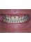 International Dental Center PV - aquiles serdan 265-E, Romantic Zone, Puerto Vallarta, Jalisco, 48380,  9