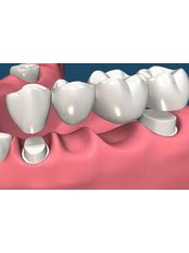 Bone Graft - 757 Dental Solutions