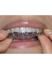 Invisalign™ - Dental America