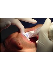 Teeth Whitening - Dental America