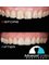 Advanced Smiles Dentistry Tijuana - German Gedovius #10489 Local 102, Zona Rio, Tijuana, BC, 22010,  10