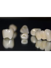 PFM Crowns - Esthetic Finish - Clínica Dental Unión
