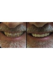 Dentist Consultation - Clinica Dental