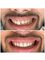 Dr. Implant Dentistry - Frida Kahlo 10410, Zona Urbana Rio Tijuana, 22010 Tijuana, B.C., Suite 410- 411, Tijuana, Baja California, 22010,  27