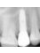 Magnolia Health Center - Dental implant 