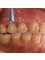 Magnolia Health Center - Dental Implant 
