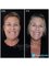 Perfect Smile Dental Implant Center - Paseo de los Heroes 9150-A6, Tijuana, Baja California, 22010,  21