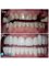 Perfect Smile Dental Implant Center - Paseo de los Heroes 9150-A6, Tijuana, Baja California, 22010,  5