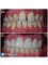 Perfect Smile Dental Implant Center - Paseo de los Heroes 9150-A6, Tijuana, Baja California, 22010,  32