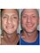 Perfect Smile Dental Implant Center - Paseo de los Heroes 9150-A6, Tijuana, Baja California, 22010,  39