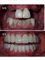 Perfect Smile Dental Implant Center - Paseo de los Heroes 9150-A6, Tijuana, Baja California, 22010,  24