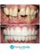 Perfect Smile Dental Implant Center - Paseo de los Heroes 9150-A6, Tijuana, Baja California, 22010,  28