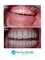 Perfect Smile Dental Implant Center - Paseo de los Heroes 9150-A6, Tijuana, Baja California, 22010,  18
