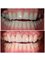 Perfect Smile Dental Implant Center - Paseo de los Heroes 9150-A6, Tijuana, Baja California, 22010,  10
