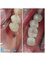 Perfect Smile Dental Implant Center - Paseo de los Heroes 9150-A6, Tijuana, Baja California, 22010,  33