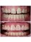 Perfect Smile Dental Implant Center - Paseo de los Heroes 9150-A6, Tijuana, Baja California, 22010,  42