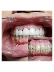 Cosmetic Dentist Consultation - Revolution Dental Care