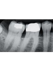 FREE Dental X-Rays - Revolution Dental Care