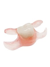 Removable Partial (Flipper) - Revolution Dental Care