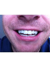 Porcelain Crown - Dent Clínica Dental