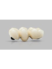 Porcelain Crown - Dr. Llamas Dental Office