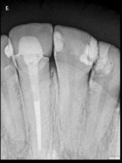 Digital Dental X-Ray - Odontología Especializada