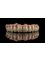 Sos Dental Tourism - Bionic Mouth Research Institute - via Ismail, 88, Chisinau, Chisinau, 2001,  23