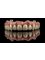 Sos Dental Tourism - Bionic Mouth Research Institute - via Ismail, 88, Chisinau, Chisinau, 2001,  4