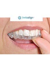 Clear Teeth Aligners - Braces and Faces Dental Clinic