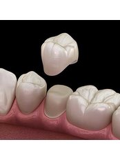 Dental Crowns - City Dent