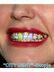 Tooth Jewellery - City Dent