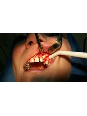 Surgical Extractions - Dento-Medical