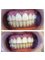 Royal Medical Center - Front crowns before and after  