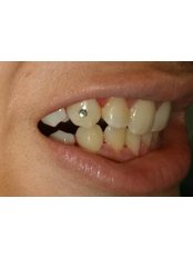 Dentist Consultation - Cosmetic Dental Studio