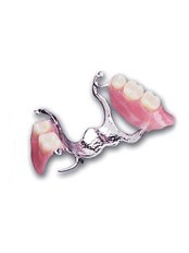 Cast Partial Dentures @ ( Smile Line ) - Smile Line - Specialist Dental Surgery
