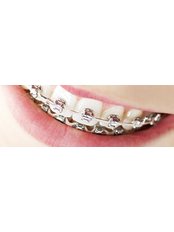 Metal Braces - Smile Line - Specialist Dental Surgery