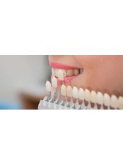 Veneers - Smile Line - Specialist Dental Surgery