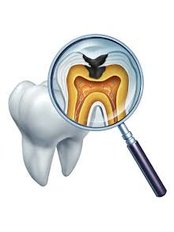 Complex Root Canal - Smile Line - Specialist Dental Surgery